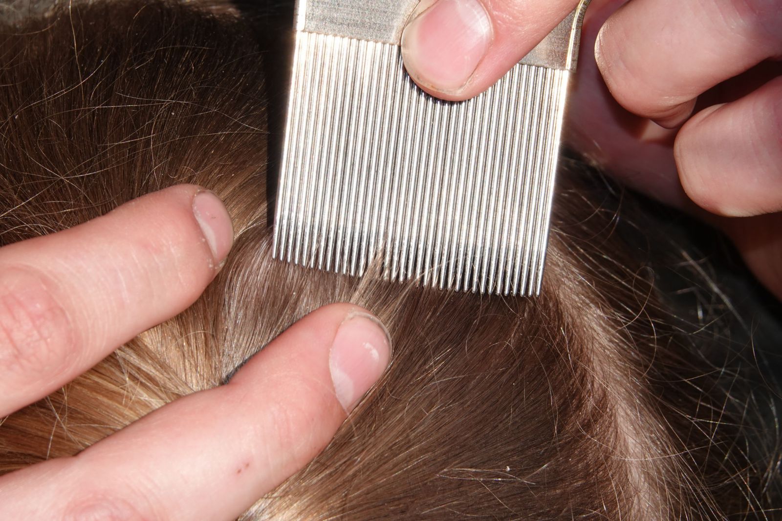 Pente no cabelo para retirar carrapato 