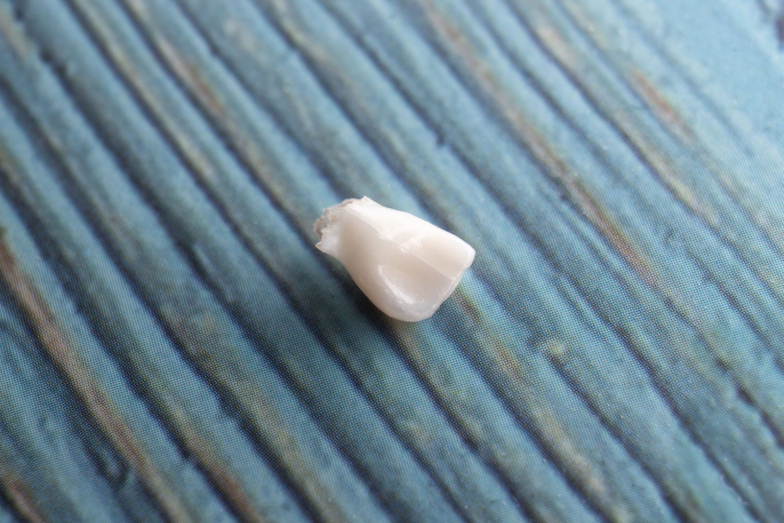 Dente quebrado caído