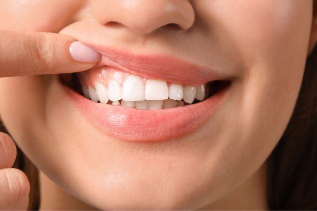 dentes brancos