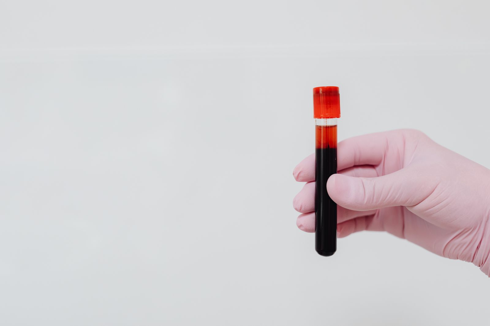 Mão segurando frasco de sangue